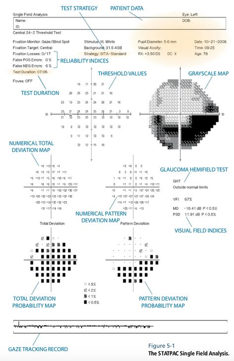 Optometry School Notes, Optometry Notes, Ophthalmology Notes, Optometrist Aesthetic, Optometric Technician, Optometry Aesthetic, Opthalmic Technician, Ophthalmic Technician, Optician Training