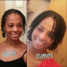 6 months of growth!#starter locs Loc Fashion Black Women, Braid Locs Starter, Locs Starter, Samantha Baker, Braid Locs, Locs Inspiration, Short Twist, Short Twists, Loc Inspiration