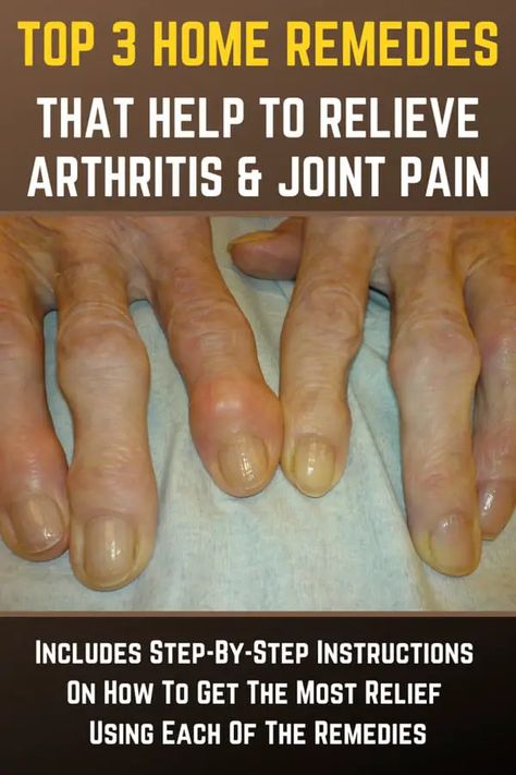 3 Natural Home Remedies That Help To Relieve Arthritis & Joint Pain Homesteading Hacks, Joints Pain Remedy, Pain Relief Remedies, Green Diy, Reduce Swelling, Natural Healing Remedies, Knee Pain Relief, Outdoor Sheds, Joints Pain Relief