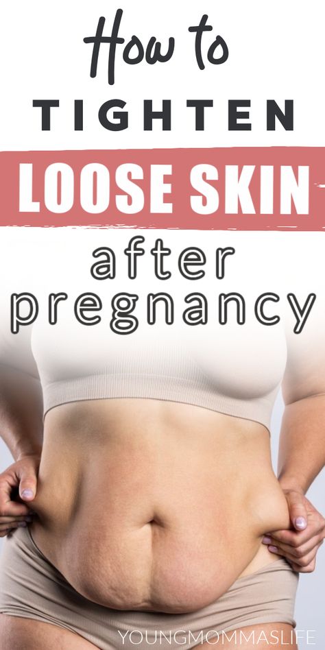 Looking for postpartum tips on how to loose the mommy pooch? Say no more! Learn how to get rid of loose belly skin fast. Tighten loose belly skin after pregnancy, after weight loss or after surgery. We'll also share a skin tightening cream that is 100% natural and safe to use during pregnancy so don't miss out! Belly After Baby, Post Pregnancy Belly, Loose Belly, Post Pregnancy Workout, Tighten Loose Skin, Postpartum Belly, Trening Fitness, Post Partum Workout, Loose Skin