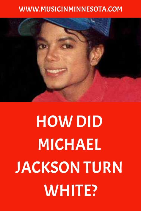 In Michael Jackson’s young days, he cruised his way into the heart of America as a member of the Jackson 5. As time went on, he became known as the King of Pop, giving the Michael Jackson Skin, Prince Michael Jackson, Young Michael Jackson, The Jackson 5, Holly Marie Combs, Psychology Disorders, King Of Pop, Jackson 5, Skin Condition