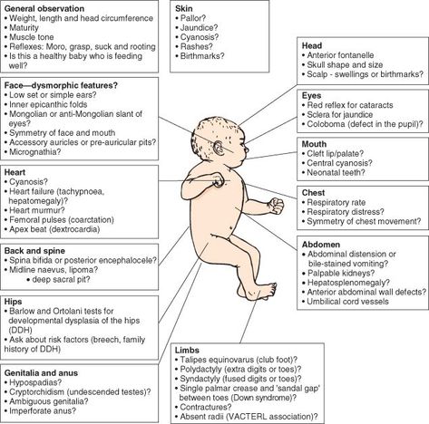 Nicu Nurse Assessment, Newborn Assessment Nursing, Maternal Newborn Nursing, Pediatric Assessment, Exam Template, Newborn Assessment, Nicu Nursing, Newborn Nursing, Midwifery Student