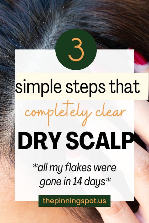 Are you struggling with an itchy, flaky scalp? Discover DIY tips and remedies to achieve a healthy scalp. We’ve gathered the best scalp health tips to help you banish scalp flakes and itchiness for good and say hello to a healthier scalp. You'll learn three simple yet effective steps to completely clear your dry scalp and how to have a scalp care routine that tackles dryness and flakes head-on.  No more flakes, just a healthy, nourished scalp Natural Dry Scalp Remedy, Itchy Dry Scalp Remedy, Get Rid Of Dry Scalp, Extremely Dry Scalp, Dry Scalp Treatment Diy, Flakey Scalp, Itchy Scalp Remedy, Dry Scalp Remedy, Dry Flaky Scalp