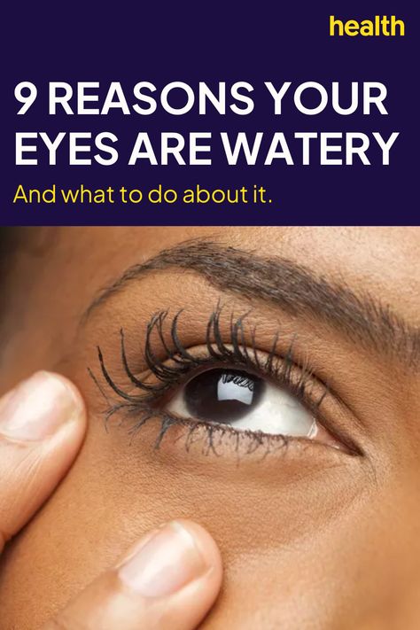 Best Eye Drops For Dry Eyes, Dry Eyes Remedy Natural Treatments, Watery Eyes Remedy, Tearing Eyes, Dry Eye Remedies, Eye Nerves, Blocked Tear Duct, Best Eye Drops, Allergy Eyes