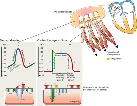 Figure 7. The action potential in the sinoatrial node and in contractile myocardial cells. Phase 4 of the action potential in the sinoatrial node is called 'pacemaker potential', because it is responsible for the spontaneous repetitive depolarization. Sinoatrial Node, Action Potential, Cardiac Sonography, Cardiac Cycle, Ecg Interpretation, Cardiac Nursing, Respiratory Therapy, Medical School Studying, Phase 4