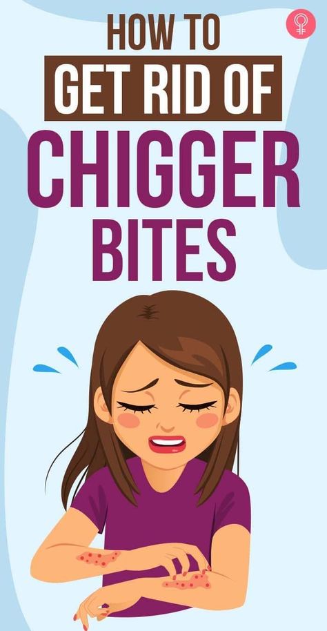 Chigger Bite Remedy, Bug Bites Remedies, Home Remedies For Bronchitis, Best Cough Remedy, Bite Relief, Kitchen Ingredients, Get Rid Of Acne, Rid Of Acne, Cold Sores Remedies