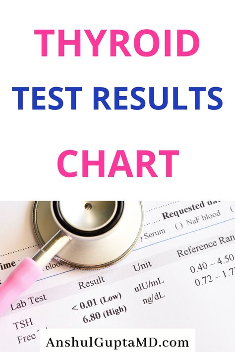 What Thyroid Tests To Ask For? Various Testing for Thyroid Function and antibodies. Optimal Thyroid Test Result Charts #thyroid #hypothyroidism #anshulguptamd Thyroid Test Results, Optimal Thyroid Levels, Low Thyroid Remedies, Thyroid Remedies, Thyroid Levels, Thyroid Test, Low Thyroid, Thyroid Symptoms, Thyroid Medication