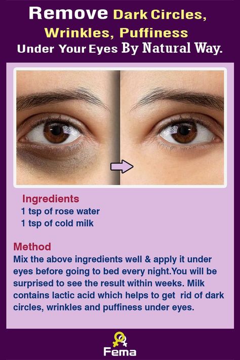 Face Skin Care Routine, Clear Healthy Skin, Natural Skin Care Remedies, Diy Skin Care Routine, Natural Face Skin Care, Ootd Instagram, Good Skin Tips, Skin Care Face Mask, Milk Cream