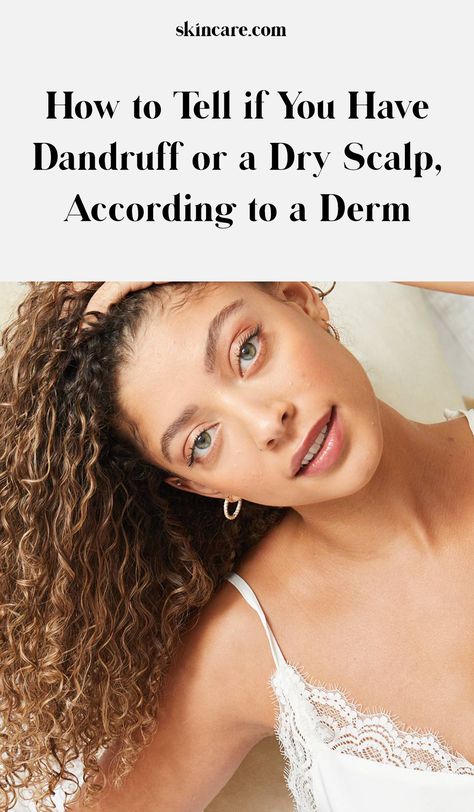 The Difference Between Dry Scalp and Dandruff How To Stop Dandruff Dry Scalp, White Flakes In Hair Dry Scalp, Flaky Scalp Remedy Diy, How To Stop Itchy Scalp, Dry Flaky Scalp Remedy, Flaky Scalp Remedy, Dry Scalp Vs Dandruff, How To Stop Dandruff, Haircare Ideas