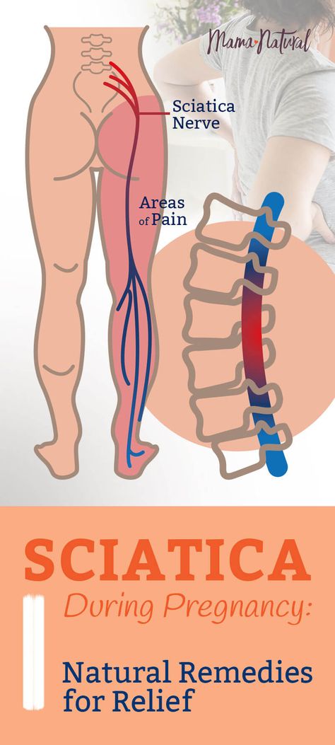 Mama Natural, Baby Kicking, Pumping Moms, Baby Sleep Problems, Sciatic Nerve, After Baby, Pregnant Mom, Sciatica, Breast Milk