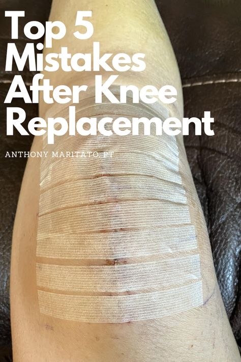 1 week post op total knee replacement Post Op Knee Replacement Exercises, Exercise After Knee Replacement, Preparing For Knee Replacement Surgery, Knee Replacement Recovery Gifts, Knee Replacement Recovery Tips, Full Knee Replacement, Knee Replacement Pain, After Knee Replacement Surgery, Knee Replacement Surgery Recovery