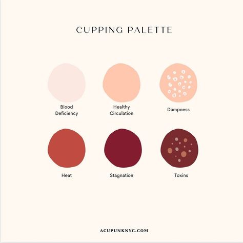 Cupping Marks Meaning, Cupping Therapy Color Chart, Hijama Cupping Therapy Poster, Cupping Therapy Aesthetic, Benefits Of Cupping Therapy, Cupping Therapy Chart Trigger Points, Hijama Cupping Therapy Logo, Cupping Placement Chart, Cupping Therapy Chart