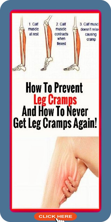 Prevent leg cramps and say goodbye to discomfort. Discover effective strategies to alleviate and prevent leg cramps. Enjoy relief and better sleep! #LegCrampRelief #MuscleHealth #PainManagement Nighttime Leg Cramps, Leg Cramps At Night, Gastrocnemius Muscle, Calf Pain, Calf Cramps, Home Medicine, Restless Leg Syndrome, Leg Cramps, Preventative Health