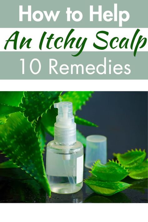 how to help itchy scalp Itching Remedies, Scalp Remedies, Itchy Scalp Remedy, Dry Scalp Remedy, Aloe Vera For Sunburn, Home Remedies For Dandruff, Scalp Itch, Home Remedies For Allergies, Warts Remedy