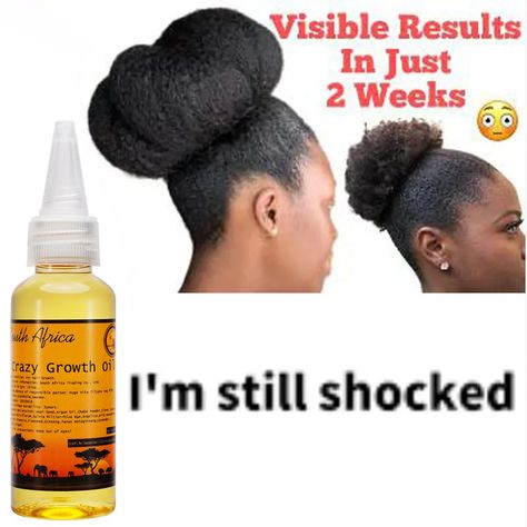 50 ml Traditional African Hair Oil GROW YOUR HAIR FASTER LONGER IN 1 W Grow Your Hair Faster, Accelerate Hair Growth, Rapid Hair Growth, How To Grow Your Hair Faster, Loss Hair, Body Cells, Scalp Oil, African Hair, Herbal Hair