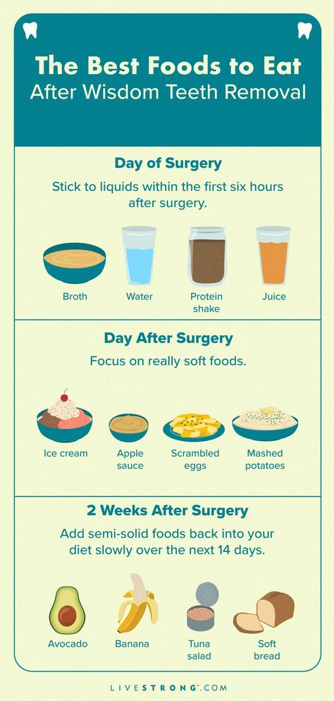 Post Wisdom Teeth Food, Wisdom Teeth Recovery Food, Wisdom Teeth Removal Food, Eating After Tooth Extraction, Wisdom Teeth Food, Wisdom Teeth Recovery, Protein Juice, Soft Foods To Eat, After Wisdom Teeth Removal