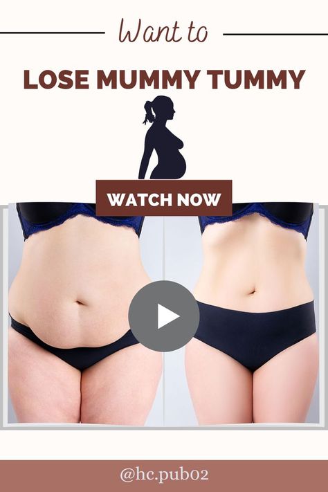 Wanting to lose that mummy-tummy? You can do this easy and simple exercise for your core and get a flat belly post-pregnancy.🤰🏻 𝐇𝐨𝐰 𝐎𝐧𝐞 𝐖𝐨𝐦𝐚𝐧 𝐃𝐢𝐬𝐜𝐨𝐯𝐞𝐫𝐞𝐝 𝐭𝐡𝐞 𝐅𝐞𝐦𝐚𝐥𝐞 𝐅𝐚𝐭-𝐋𝐨𝐬𝐬 𝐂𝐨𝐝𝐞 𝐌𝐢𝐬𝐬𝐞𝐝 𝐛𝐲 𝐌𝐨𝐝𝐞𝐫𝐧 𝐌𝐞𝐝𝐢𝐜𝐢𝐧𝐞 𝐀𝐧𝐝 𝐋𝐨𝐬𝐭 𝟖𝟒𝐥𝐛𝐬 𝐔𝐬𝐢𝐧𝐠 𝐚 𝐒𝐢𝐦𝐩𝐥𝐞 𝟐-𝐒𝐭𝐞𝐩 𝐑𝐢𝐭𝐮𝐚𝐥 𝐓𝐡𝐚𝐭 𝟏𝟎𝟎% 𝐆𝐮𝐚𝐫𝐚𝐧𝐭𝐞𝐞𝐬 𝐒𝐡𝐨𝐜𝐤𝐢𝐧𝐠 𝐃𝐚𝐢𝐥𝐲 𝐖𝐞𝐢𝐠𝐡𝐭 𝐋𝐨𝐬𝐬 #bellyfat #weightloss #bellyfatloss #fatloss #bellyfatworkout Lose Postpartum Belly, Mommy Tummy Workout, Mummy Tummy, Mommy Tummy, Mommy Belly, Simple Exercise, Postpartum Belly, Tummy Workout, Post Pregnancy