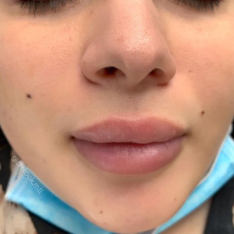 Cute Face Moles, Beauty Spot Tattoo Face, Face Moles Beauty Marks Aesthetic, Cute Moles On Face Aesthetic, Beauty Moles On Face, Women With Moles On Face, A Mole On The Face, Beauty Moles Aesthetic, Mole Above Lip Beauty Marks