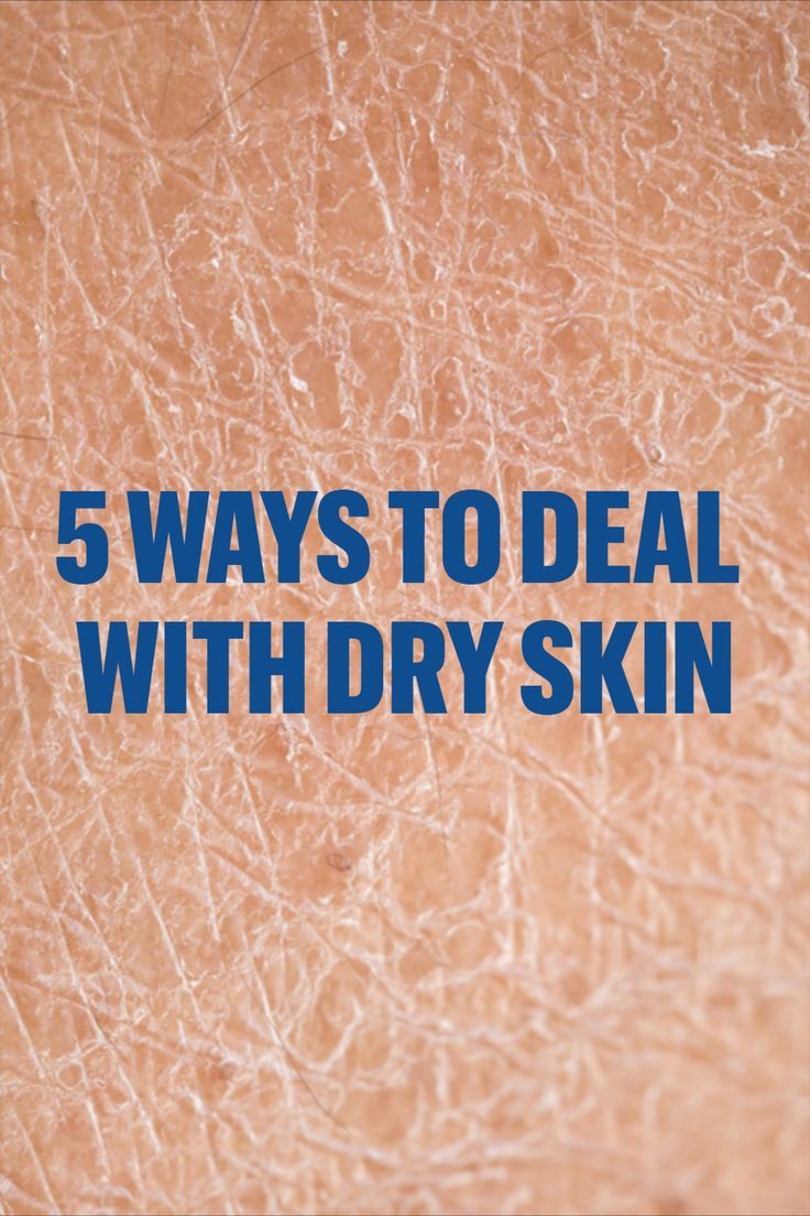 Winter Dry Skin Care, How To Remove Dryness From Face, How To Remove Dry Skin From Face, What To Do For Dry Skin, Dry Skin Remedies For Body Winter, Best Soap For Dry Skin, How To Get Rid Of Dry Skin, Dryness On Face, Dry Flaky Skin On Face