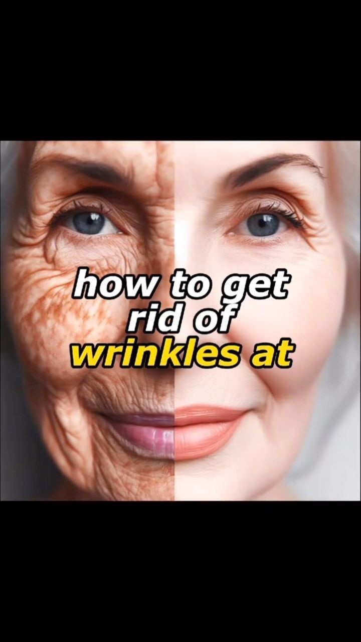 Say Goodbye to Wrinkles at Home 👩🏽‍🦳 Discover an easy home remedy to reduce wrinkles naturally! Learn how to create an orange-based cream… | Instagram 🌷 Get Youthful Glow - Click Here! forehead wrinkles, wrinkles remedies face 😘 Please re-pin 😍💞 How To Remove Wrinkles On Face, Face Taping For Wrinkles, Wrinkle Remedies Face, Remove Wrinkles From Face, Natural Wrinkle Reducer, Natural Wrinkle Remedies, Wrinkles Remedies, Wrinkles Remedies Face, Home Remedies For Wrinkles