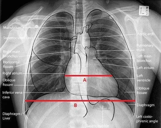 the chest is shown with red lines in front of it and an arrow pointing to the right