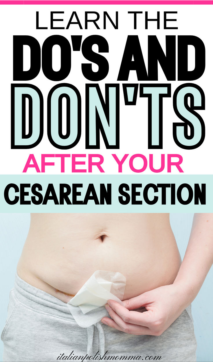 Cesarean Section Recovery tips and the do's and don'ts after a c-section, c-section recovery essentiasl C Section Exercise, C Section Recovery Essentials, C Section Tips, Mom Tips Parenting, Pregnancy Trimesters, C Section Scar, C Section Workout, Post C Section, First Time Mom Tips