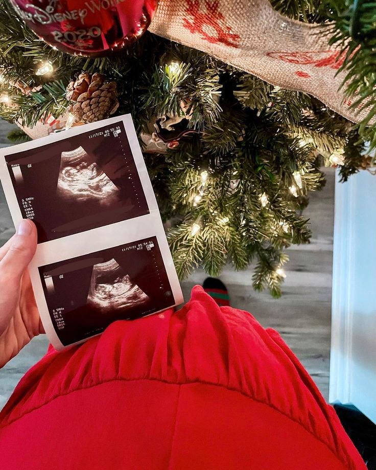 a person holding up an x - ray photo in front of a christmas tree