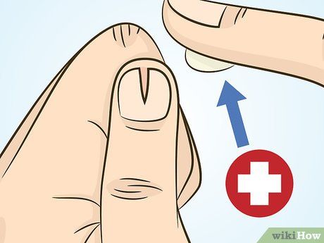 How To Repair A Split Fingernail, How To Repair Split Nails, How To Fix A Split Nail, Repair Split Nail, How To Stop Nails From Splitting, Repair Nails After Acrylics, Split Fingernails Remedies, Nail Splitting Remedies, Nail Break Repair