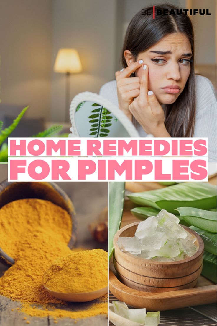 Home remedies for pimples How To Prevent Pimples, How To Reduce Pimples On Face, Fast Acne Remedies, Pimples On Face Meaning, Pimple Remedies Overnight, Hard Pimple, Pimple Remedies, Herb Remedies, Remedies For Pimples