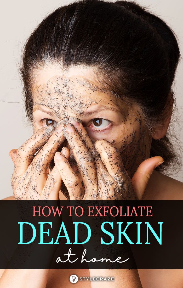 How To Remove Dead Skin Naturally? Blackheads And Whiteheads, Brown Spots On Face, Spots On Face, Glow Skin, Get Rid Of Blackheads, Flaky Skin, How To Exfoliate Skin, Clean Pores, Skin Issues