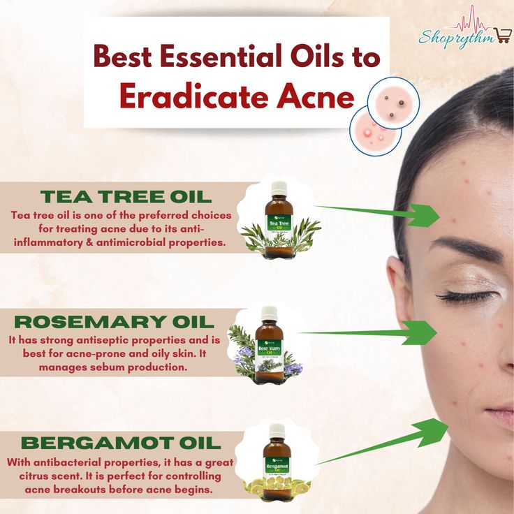 Tea Tree Oil For Acne, Wedding Skincare, Essential Oils For Face, Bergamot Oil, Skin Secrets, Holistic Beauty, Beauty Oil, Essential Oil Blends Recipes, Aromatherapy Oils