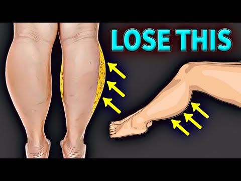 Who doesn't like having toned legs? But is your calf fat is not letting you to get the same? Wonder how to reduce calf fat? Try doing the following exercises. Knee Fat Exercises, Fat Calves, Slim Calves, Calf Exercises, Reduce Thigh Fat, Exercise To Reduce Thighs, Lose Thigh Fat, Effective Workout Routines, Workout Without Gym