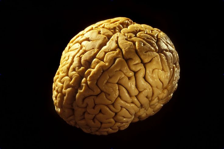 a close up of a human brain on a black background