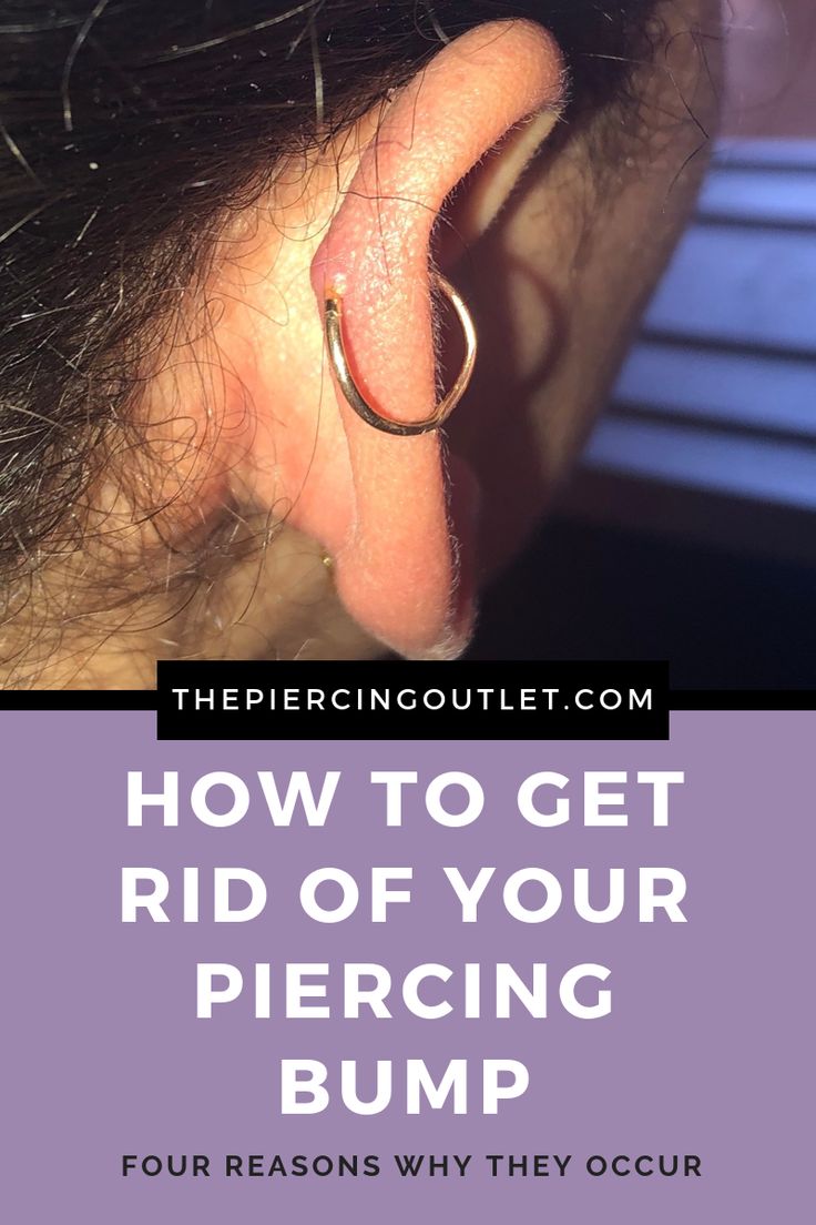 a woman's ear with the words how to get rid of your piercing bump