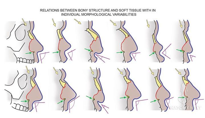 an image of different stages of surgery in the human body, including craning and retrieving