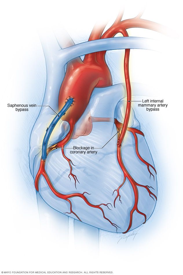 an image of the human heart and blood vessels