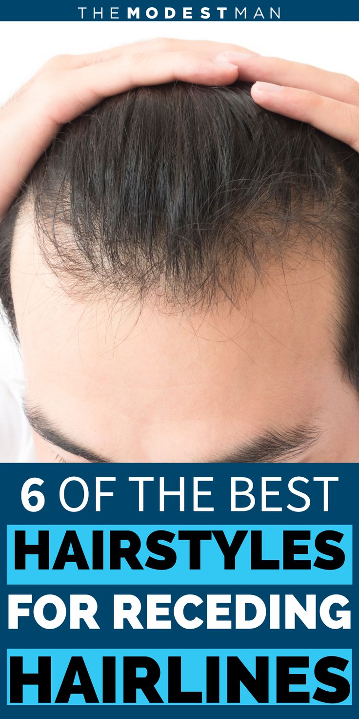 Men’s Hair Styles For Receding Hairline, Men Thinning Haircut, Men Receding Hairline Hairstyles, Haïr Style For Men, Hairstyles For Men With Receding Hair, Men’s Short Hairstyles Receding Hairline, Haircut For Men With Big Foreheads, Hairstyle For Receding Hairline Mens, Men High Fade Haircut