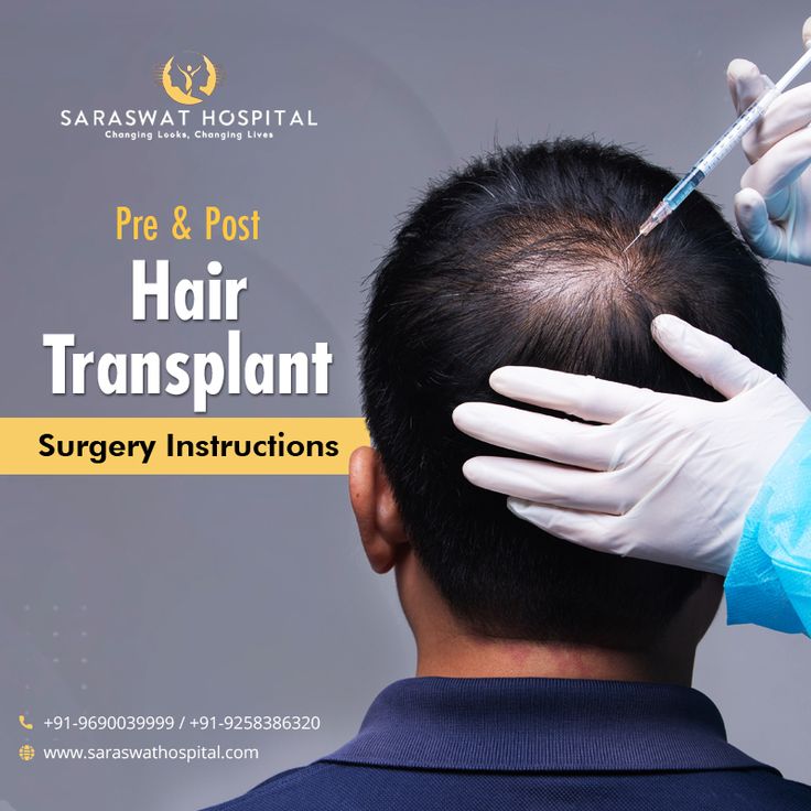 Do you want to know about all the instructions that you have to follow before and after your hair transplant surgery to be prepared? Read this blog to find out. #HairTransplant #HairTransplantSurgery #HairTransplantClinic #HairTransplantSurgeon Hair Transplant Before And After, Fruit Recipes Healthy, Hair Transplant Surgery, After Surgery, Hair Transplant, A Doctor, Natural Remedies, Surgery, The Top