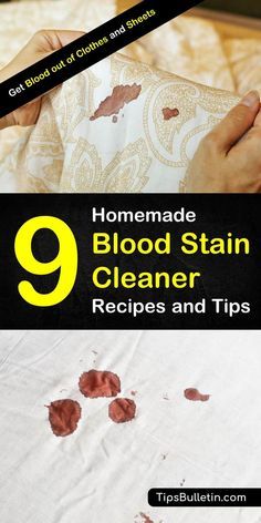 the 9 homemade blood stain cleaner recipes and tips to use them on your bed sheets