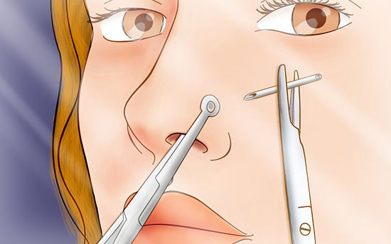 an image of a woman getting her teeth checked