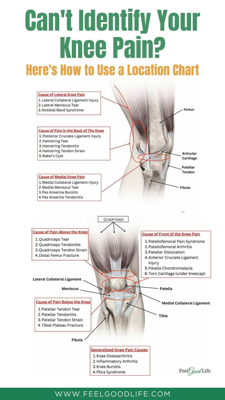 Struggling to identify your knee pain? Learn how to utilize a knee pain location chart to narrow down potential causes. With this guide, you can understand the intricate anatomy of the knee and how different types of pain correlate with specific conditions. Perfect for beginners and those seeking better knowledge about their body. #kneepain #painmanagement #healthtips #exercises #painlocationchart Medial Knee Pain, Anatomy Of The Knee, Knee Pain Relief Remedies, Patellofemoral Pain Syndrome, Knee Problem, Pain Relief Remedies, Ligament Injury, Knee Pain Relief, Medical Anatomy