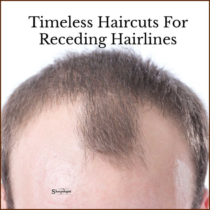 Short Hair Men Receding Hairline, Men Haircuts With Beards, Buzz Cut For Receding Hairline, Mens Hairstyles Receding Hairline Thinning Hair Men Haircuts, Short Fade Haircut Men Thinning Hair, Classic Male Haircut, Hair Cuts For Receding Hairline Men, Men’s Haircuts For Receding Hairline, Mens Haircut For Balding Men