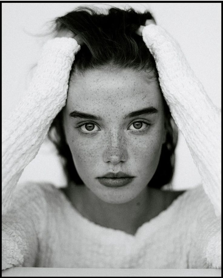 a black and white photo of a woman with freckled hair covering her eyes