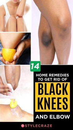 How To Lighten Knees, Dark Knees, Teknik Makeup, Dark Elbows, Make Up Foundation, Lifting Facial, Skin Face Mask, Dark Underarms, Beauty Tips For Glowing Skin