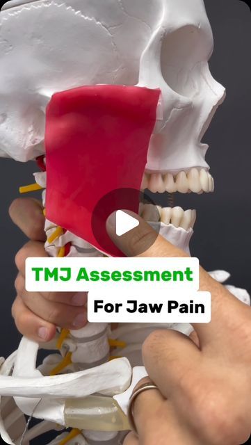 Dr. Joe Damiani - TMJ, Head & Neck Specialist on Instagram: "Comment the word ‘TMJ’ on this post if you need help getting rid of Jaw Pain and I’ll help you out! 

Is your jaw stiff or painful? Do you have trouble opening all the way? Maybe when you yawn or attempt to eat a large piece of food you can’t quite open wide or it really hurts when you do?

Well, most people automatically assume it’s the muscle and therefore they need to massage it. But very very commonly when there is stiffness, it’s a joint issue NOT a muscle issue. A muscle issue will feel achy and painful and like there’s an uncomfortable light stretch occurring when moving but rarely does it result an actual stiffness or limited motion.

Therefore, if your solution to jaw stiffness is massaging the muscle, you’ll be in a cyc Tmj Exercises, Tmj Massage, It Really Hurts, Jaw Pain, Head And Neck, Pain Relief, Massage, Motion, Instagram