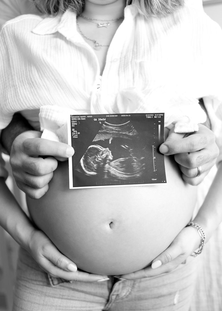 a pregnant woman holding her stomach with an x - ray