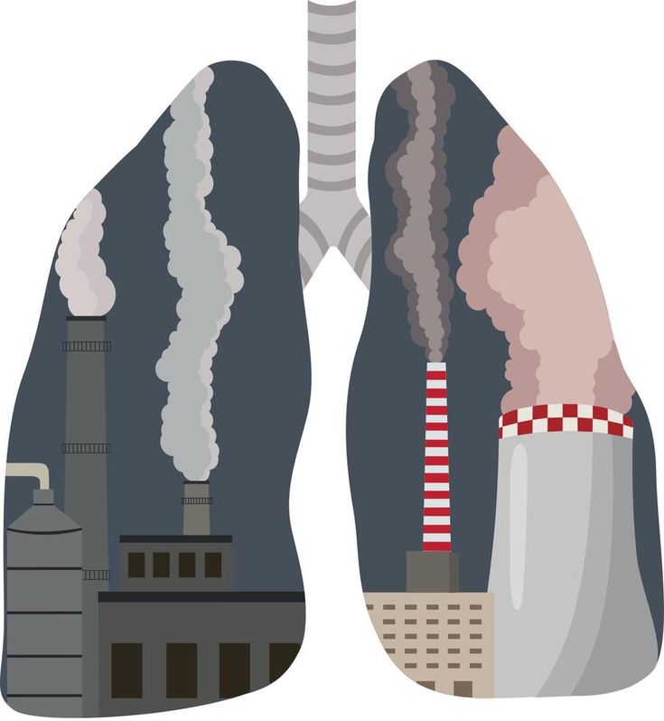 Air pollution. Industrial plant. Exhaust gases pollute the atmosphere of the city and enter the lungs. respiratory diseases. Toxic smog. Fine dust, air pollution, industrial smog Smog Aesthetic, Respiratory Disease, Air Pollution Art, Polluted Air, Sound Pollution Drawing, Pollution Aesthetic, Air Pollution Drawing, Pollution Drawing, Environment Pollution