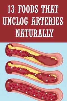 Clear Arteries, Unclog Arteries, Lower Cholesterol Naturally, Low Cholesterol Diet, Clogged Arteries, Heart Healthy Diet, Cholesterol Lowering Foods, Cholesterol Diet, Makanan Diet