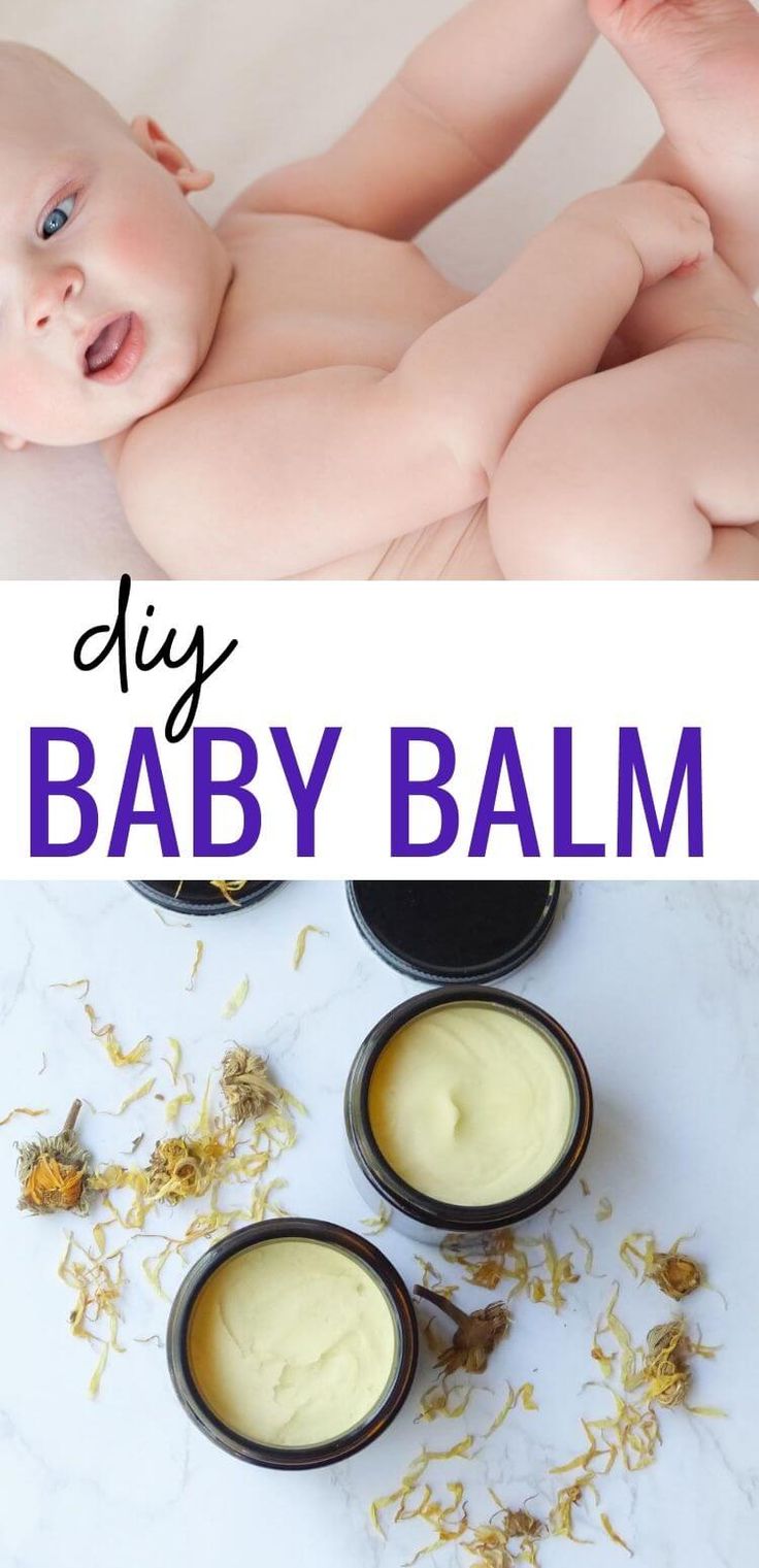 Breastmilk Lip Balm, Body Balm Recipe, All Natural Baby Products, Diy Balm, Baby Dry Skin, Homemade Balm, Natural Baby Products, Baby Moisturizer, Baby Acne