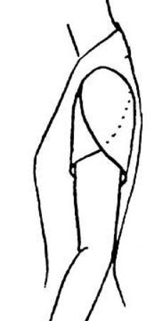 the arm is shown in black and white, with no arms or legs on it